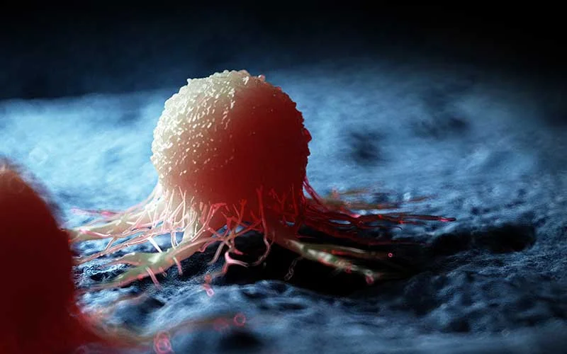 medically accurate illustration of a cancer cell