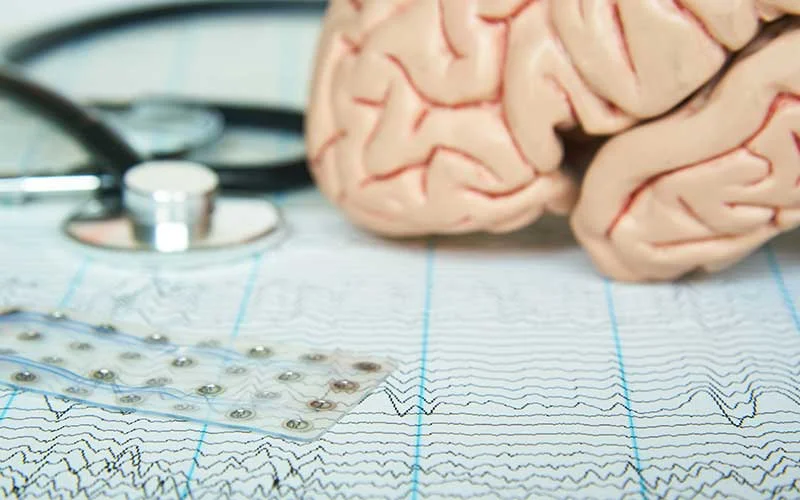 Human brain model and a black stethoscope on background